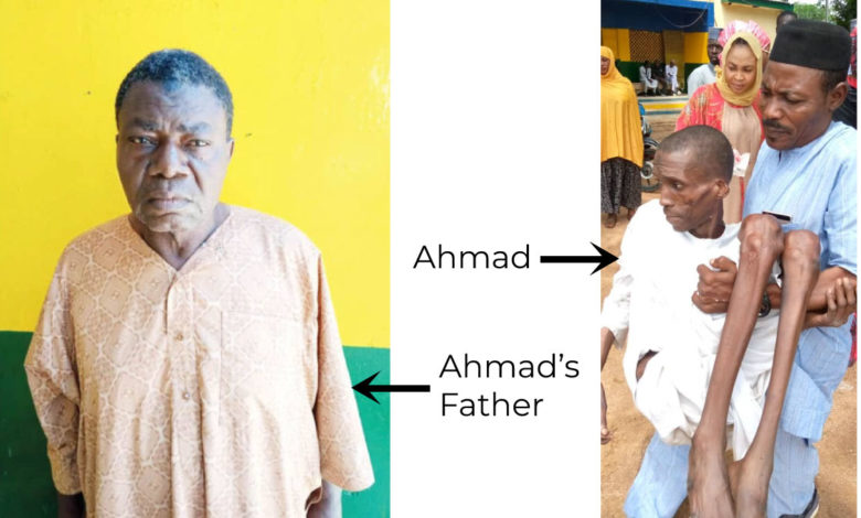 Story Of Ahmad, The 30-Year-Old Man Locked Up By Parents For 7 Years