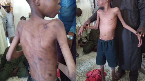 Another Starved, Tortured Boy Rescued From Step Mother In Maiduguri, Borno State