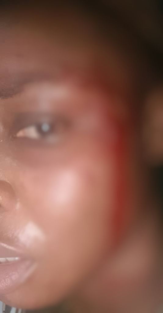 Lady Escapes Death While Going for NIN Registration In Ibadan