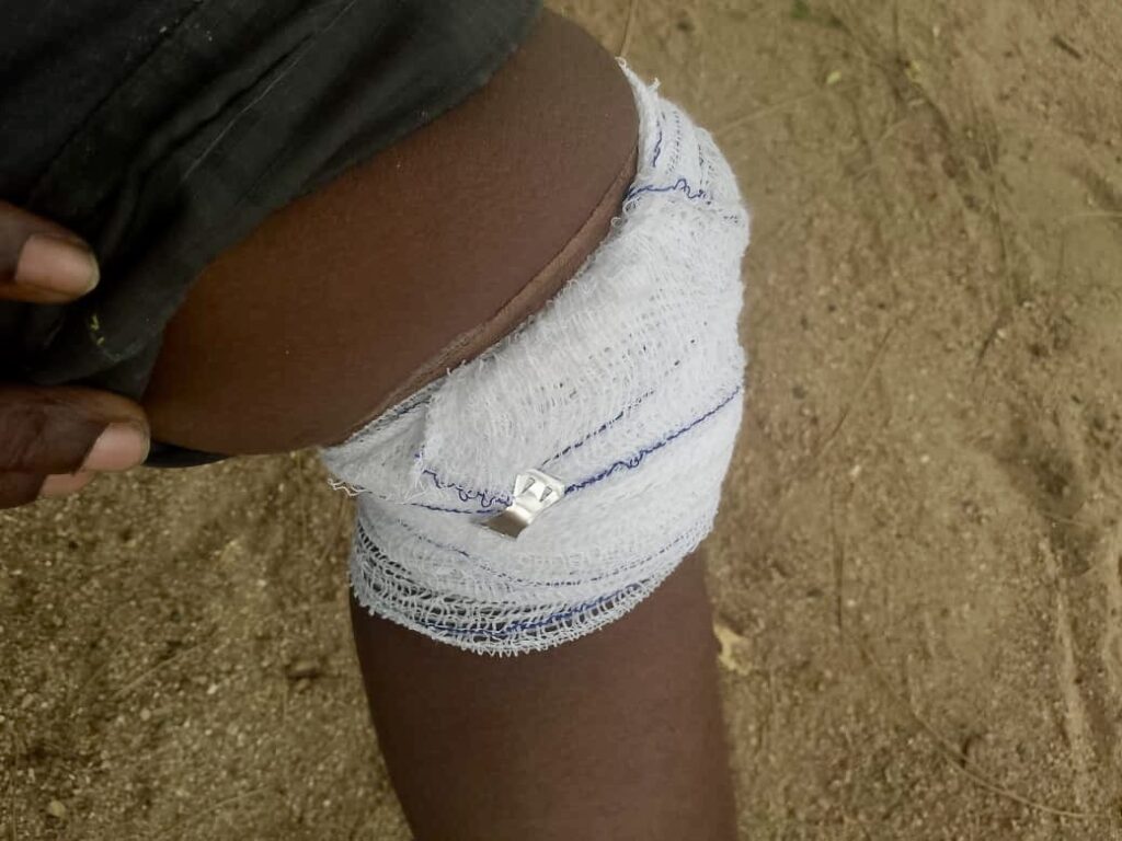 A close-up of a bandaged knee with a safety pin securing the bandage, with a backdrop of sandy ground.