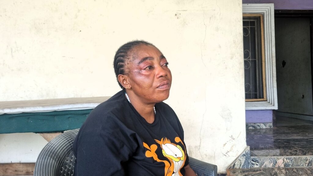 Woman sitting outdoors looking pensive, with subtle emotion on her face, wearing a cartoon character T-shirt.