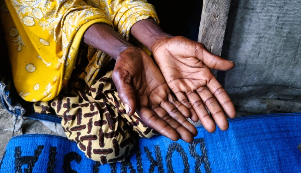 Person with outstretched hands, wearing a yellow patterned garment, sitting on a blue woven mat.