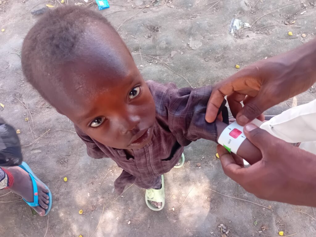 A child looking up at the camera while an adult measures their upper arm circumference with a malnutrition measurement tape.