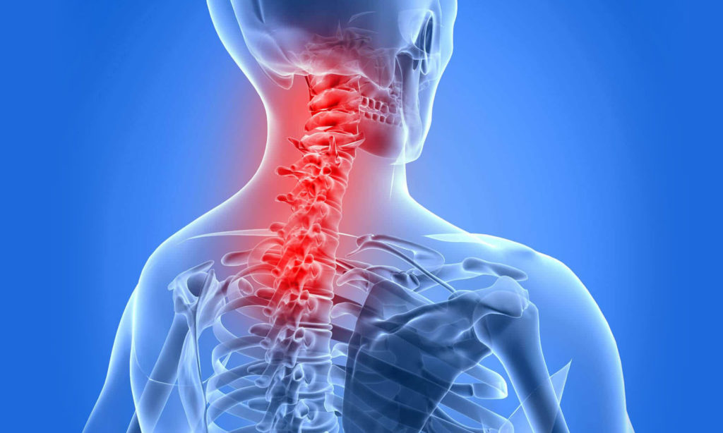 X-ray illustration showing a human's neck and upper spine highlighted in red to indicate pain or injury.