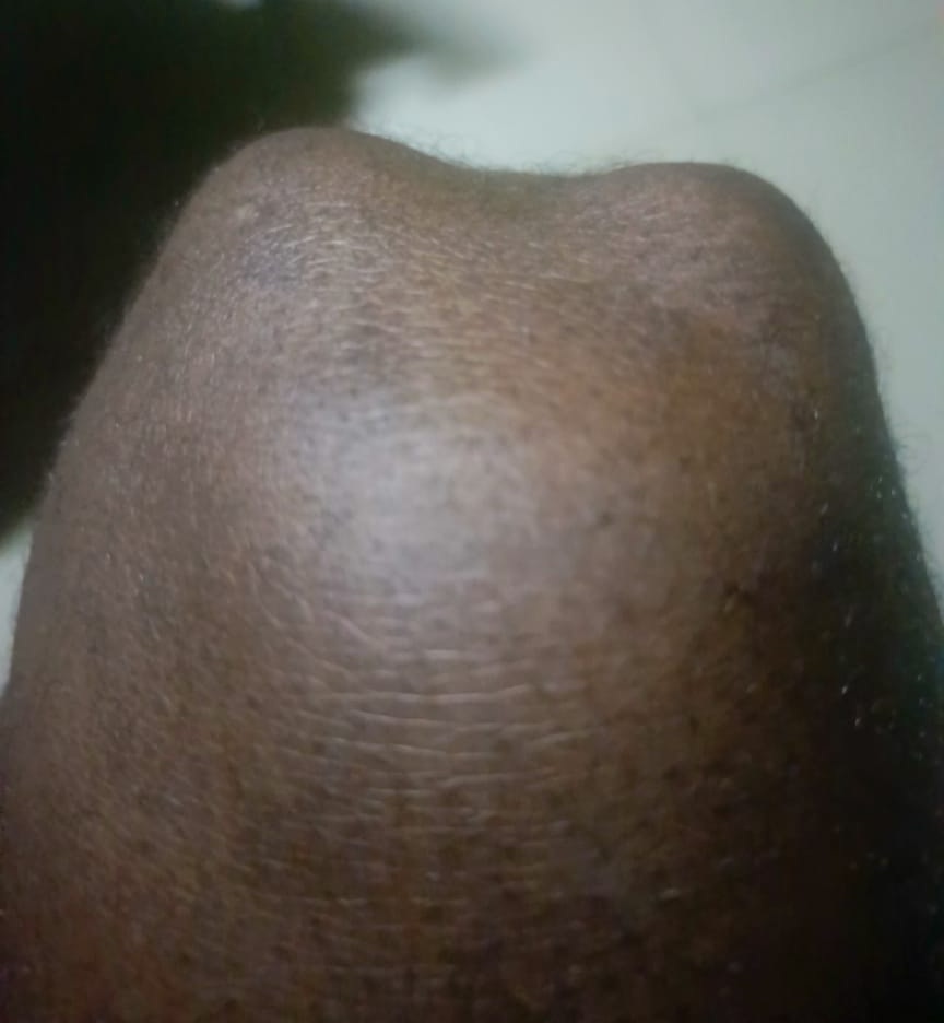 Close-up of a textured surface of a knee, showing details of the skin.