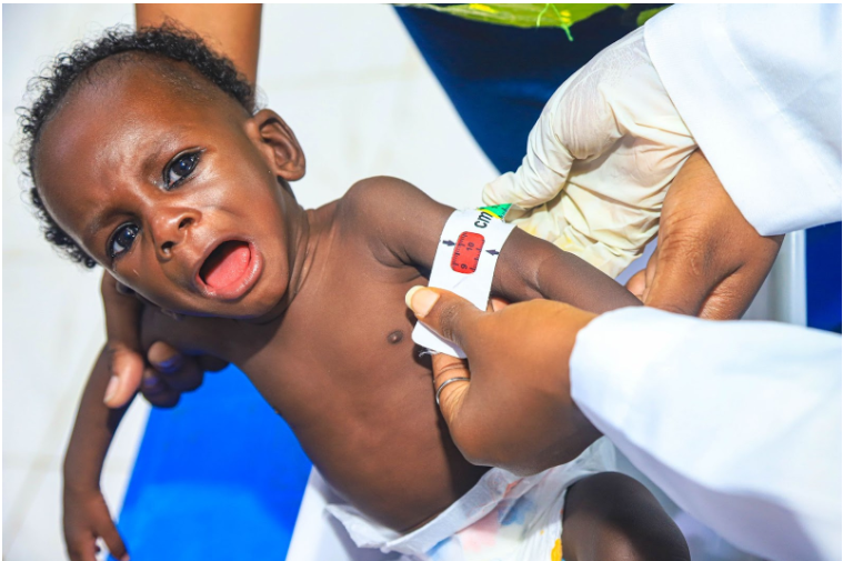 A baby is being measured with a Mid-Upper Arm Circumference (MUAC) tape by a gloved healthcare worker.