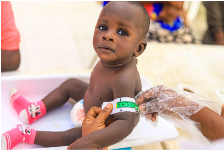 A child sitting while an adult measures their arm circumference to assess health, wearing patterned socks and a disposable diaper.