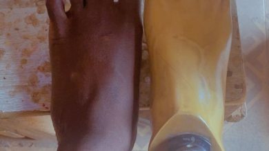A foot next to a prosthetic foot on a wooden surface, both with pink nail polish.
